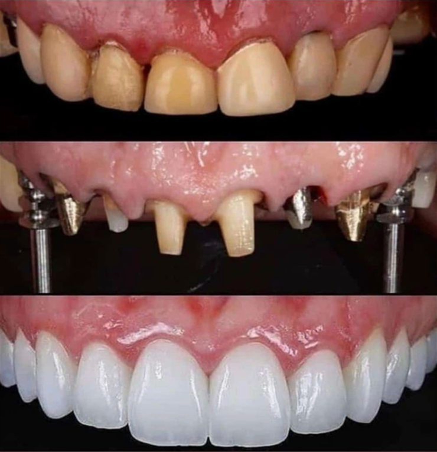 Resultado final do tratamento