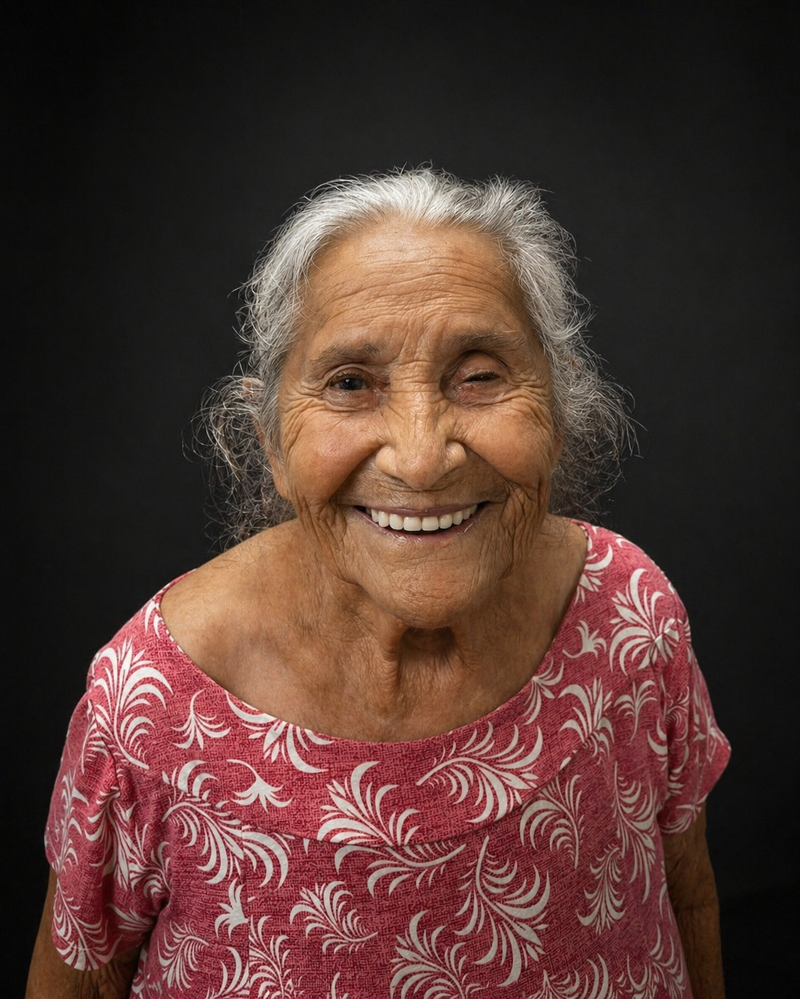 Resultado com prótese total personalizada