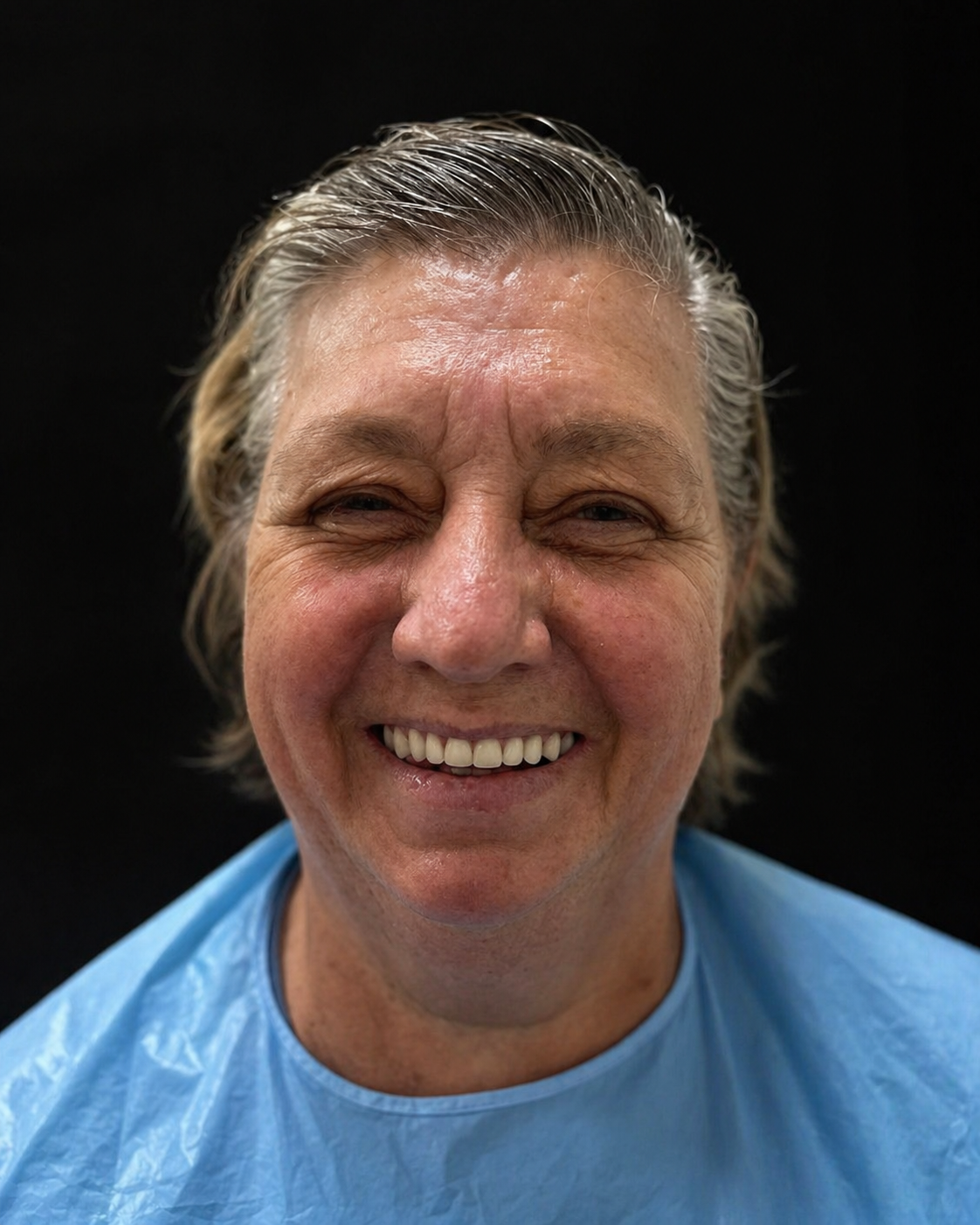 Caso de carga imediata